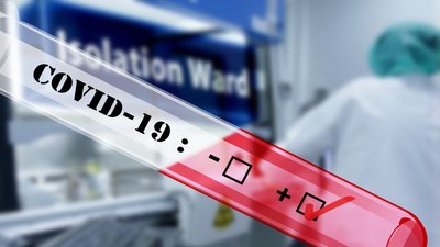 Найбільше від початку пандемії: 157 волинян за добу захворіли на COVID-19. П'ятеро волинян померло