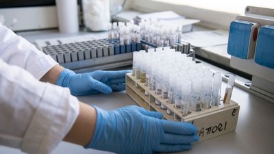 137 випадків захворювання на коронавірус виявили за добу на Полтавщині