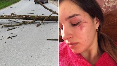 На Прикарпатті впало дерево на школярку, яка поверталася зі школи