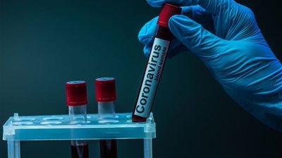 Плюс 42 інфіковані коронавірусом людини зафіксували у Сумській області
