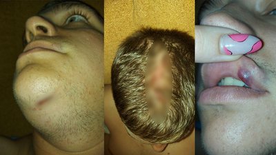"Випльовував уламки своїх зубів": харківський студент звинувачує охорону саду Шевченка у побиті "Випльовував уламки своїх зубів": харківський студент звинувачує охорону саду Шевченка у побиті