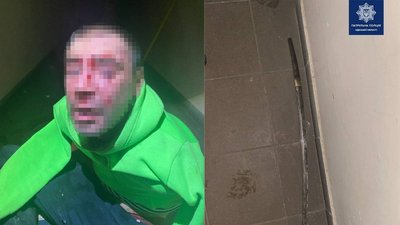 В Одесі чоловік з катаною влаштував погром у багатоповерхівці – поліція