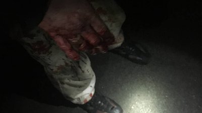 У Луцьку, ламаючи двері магазину, травмувався грабіжник У Луцьку, ламаючи двері магазину, травмувався грабіжник