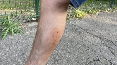На Дніпропетровщині виявили сказ у кота, який покусала чотирьох людей На Дніпропетровщині виявили сказ у кота, який покусала чотирьох людей