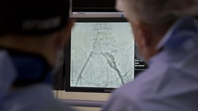 У Вінниці провели унікальну кардіохірургічну операцію