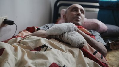 пацієнт лікарні невідкладної допомоги з обмороженням кінцівок