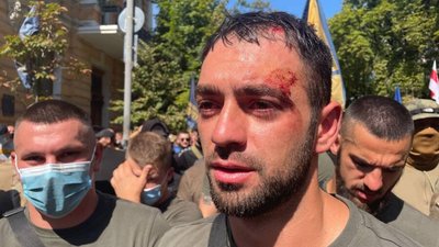 Під ОПУ сталася сутичка між силовиками та націоналістами, є травмовані