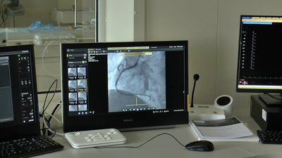 Монітори, через які спостерігають за станом пацієнта Монітори, через які спостерігають за станом пацієнта