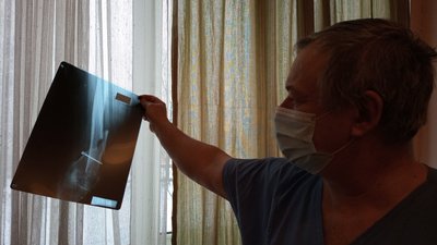 Внаслідок негоди в Ужгороді 6 травмованих Внаслідок негоди в Ужгороді 6 травмованих