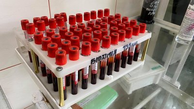 На Львівщині 28 % із проведених ПЛР-тестів показали позитивний результат