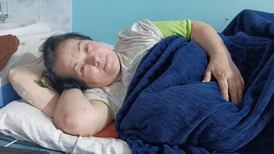 Вчиться ходити заново: жителька Миколаєва отримала 16 поранень після вибуху російського снаряда