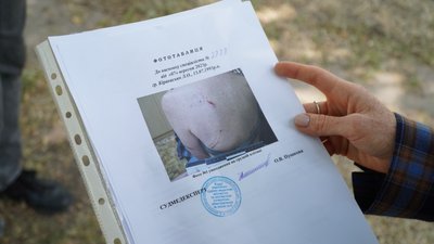 Спровокували чи напав без причини: у Дніпрі собака травмував жінку Спровокували чи напав без причини: у Дніпрі собака травмував жінку