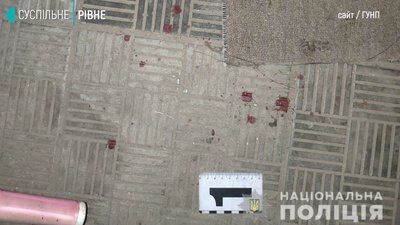 Чоловік у лікарні: на Рівненщині жінка не стала терпіти знущання Чоловік у лікарні: на Рівненщині жінка не стала терпіти знущання