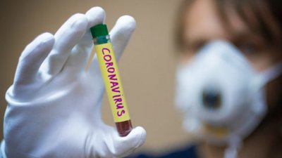 COVID-19 на Сумщині: 109 людей інфікувалися за добу, одна - померла