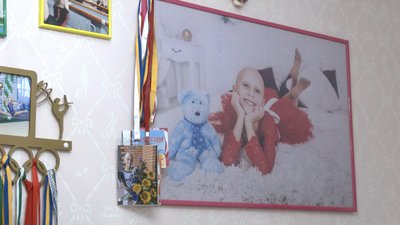 фото дитини з алопецією фото дитини з алопецією