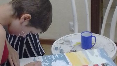 Дівчинка, яка поранила обличчя під час обстрілу у Чугуєві, готується до другої пластичної операції Дівчинка, яка поранила обличчя під час обстрілу у Чугуєві, готується до другої пластичної операції
