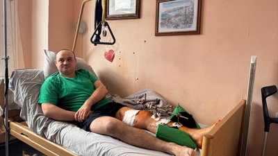 Поліцейський, якого поранило під час перестрілки на Корсунщині