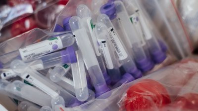 На Вінниччині за добу виявлено 147 нових випадків COVID-19