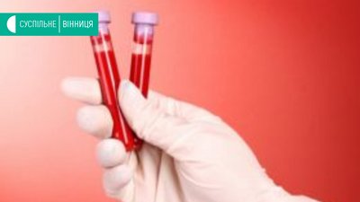 Вінниччина отримала 9 тисяч ПРЛ-тестів від українського виробника