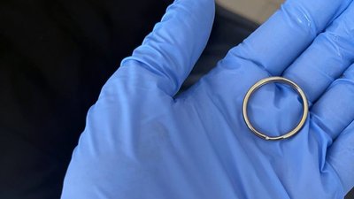 "Не помітила самого моменту, як він ковтнув": у реанімації дворічний хлопчик, який проковтнув два магніти "Не помітила самого моменту, як він ковтнув": у реанімації дворічний хлопчик, який проковтнув два магніти