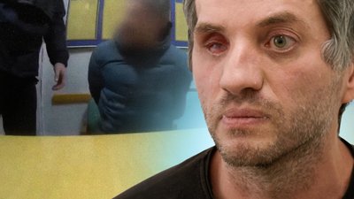 Ветеран з Чернігова звинувачує патрульних у побитті