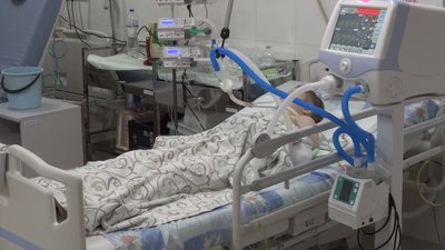 У Харкові пораненого під час російського обстрілу хлопчика підключили до ШВЛ У Харкові пораненого під час російського обстрілу хлопчика підключили до ШВЛ