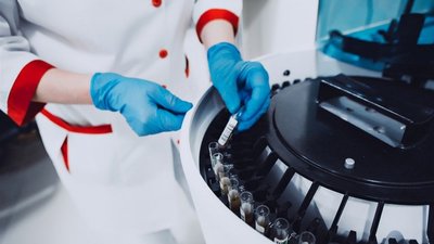 Новий рекорд: за добу захворювання на COVID-19 підтвердили у 1357 мешканців Одещини