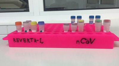 Стало відомо, скільки хворих на Харківщині заразилися COVID-19 за кордоном