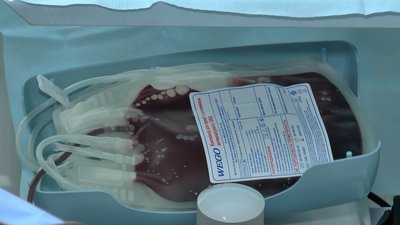 У Львівському обласному центрі служби крові бракує донорів