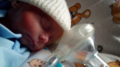 У Чернівцях медики виходили немовля, яке народилось з вагою майже 700 грам У Чернівцях медики виходили немовля, яке народилось з вагою майже 700 грам