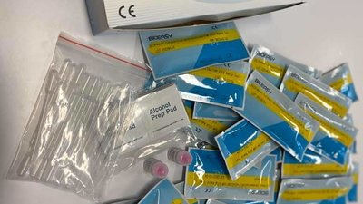 19 або 20 березня Полтавщина отримає експрес-тести для виявлення короновірусу