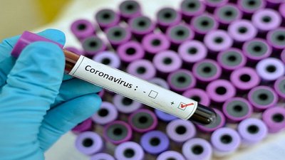 172 нові випадки захворювання на коронавірус виявили за добу на Полтавщині