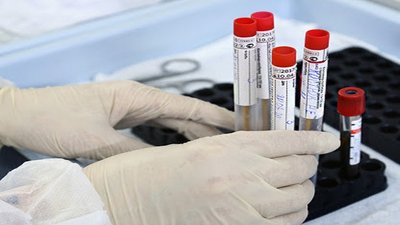 За минулу добу у 39 жителів області виявили коронавірус, одна людина померла