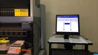 У вінницькому центрі боротьби зі СНІДом роблять ПЛР-тести У вінницькому центрі боротьби зі СНІДом роблять ПЛР-тести