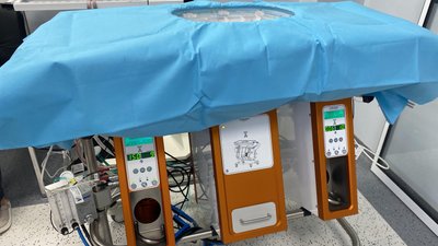 У Львові завдяки апарату Liver Assist пересадили печінку через 14 годин після взяття від донора У Львові завдяки апарату Liver Assist пересадили печінку через 14 годин після взяття від донора