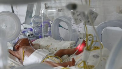 Завдяки догляду медиків поступово дитина набирає вагу Завдяки догляду медиків поступово дитина набирає вагу