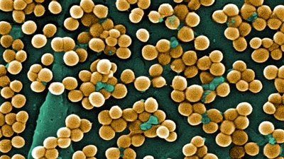 Фотографія культури Staphylococcus aureus, отримана за допомогою електронного мікроскопу Фотографія культури Staphylococcus aureus, отримана за допомогою електронного мікроскопу