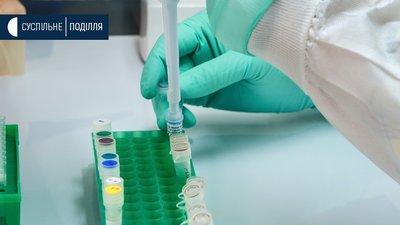 На Хмельниччині зросла кількість хворих із підозрою на COVID-19
