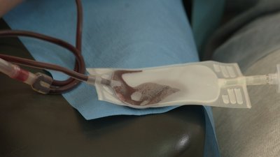 "Потреба в донорах крові зросла". У львівській лікарні реконструюють відділення трансфузіології