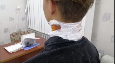 У Херсоні поліція затримала чоловіка, який підстрелив 17-річного хлопця У Херсоні поліція затримала чоловіка, який підстрелив 17-річного хлопця