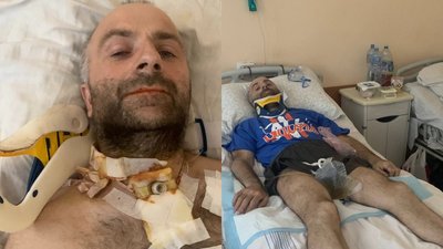 Тернопільський боєць Володимир Костюк проходить реабілітацію Тернопільський боєць Володимир Костюк проходить реабілітацію