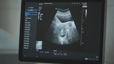 Людські ембріони створюються за допомогою штучного інтелекту
