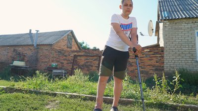 Роздробило ногу вибухом "пелюстки": як відновлюється 13-річний Назар з Харківщини