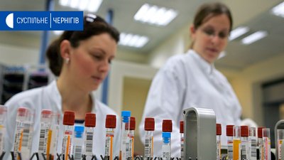 За минулу добу в Чернігівській області виявили 7 хворих на коронавірус