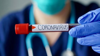 На Чернігівщині за минулу добу COVID-19 виявили у 48 людей