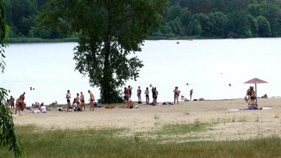 Житомирські лікарі попереджають про шкоду від надмірного перебування на сонці