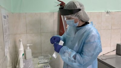 Один день з життя лаборанта: як працюють фахівці з діагностики у Франківську