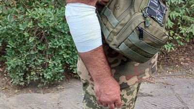 Інцидент у військовій частині на Миколаївщині: бійці отримали тілесні ушкодження Інцидент у військовій частині на Миколаївщині: бійці отримали тілесні ушкодження