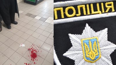 Побиття хасида в уманському супермаркеті: відкрили карну справу