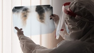 "Приїжджають пізно, бо лікарня далеко". Як COVID-19 лікують у гірській місцевості Буковини "Приїжджають пізно, бо лікарня далеко". Як COVID-19 лікують у гірській місцевості Буковини